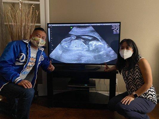 Photo of me and my husband next to the TV monitor displaying the ultrasound images.