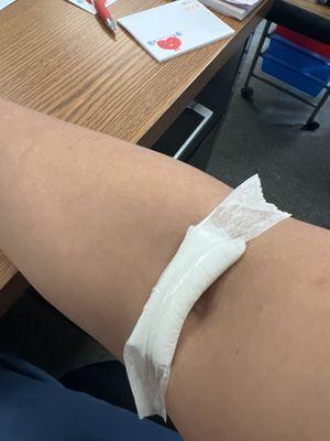 Blood drawn!