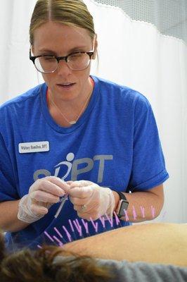 Dry Needling, performed by Whitney Hamilton, PT, DPT, OCS. Have questions? Visit our website for more details.