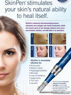 Microneedling