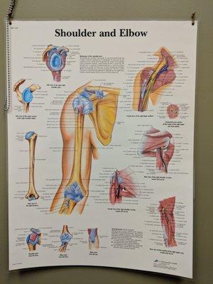 This handy poster in the exam room illustrates what's causing my pain