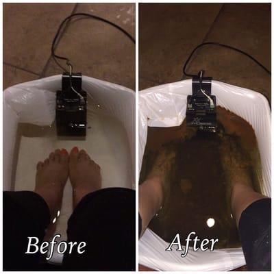 Ion Foot Detox