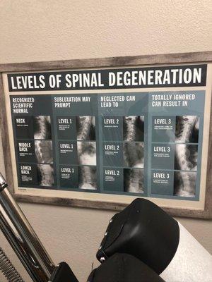 Levels of spinal degeneration