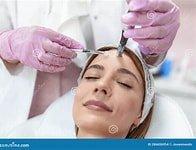 Microneedling for skin rejuvenation.