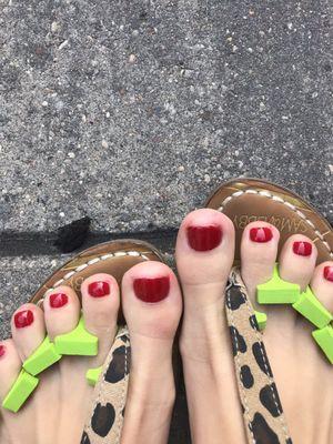 Bad pedicure