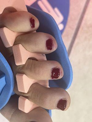 No comments , the worse pedicure