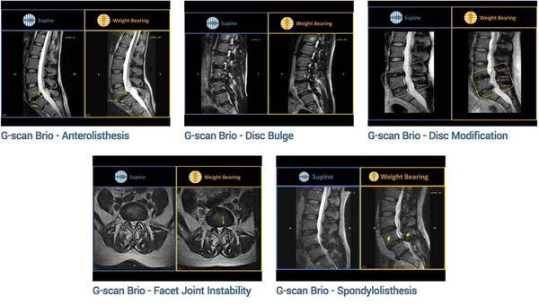 Beautiful MRI images on a weight bearing patient