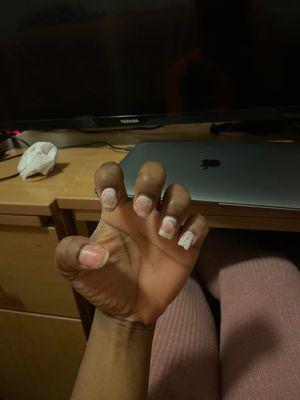 Horrible Nails