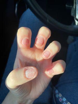 The shellac peeling after I did my seat belt my cuticules uncut and hang nails not clipped and no oil or lotion