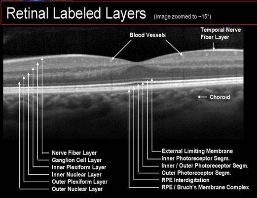 Our imaging technology can scan all 10 layers of the retina