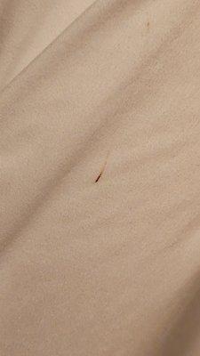 Blood on side of comforter