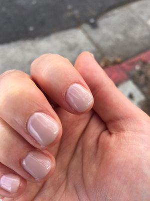 Day 0: manicure, cut on fourth finger cuticle