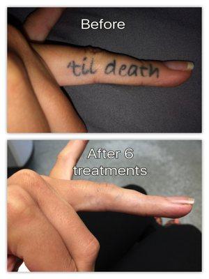 Till death? It doesn't have to be that way anymore :)