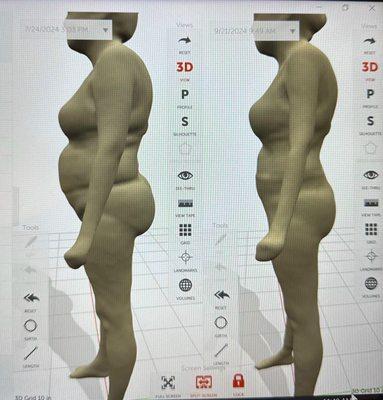 Styku Body Scan.