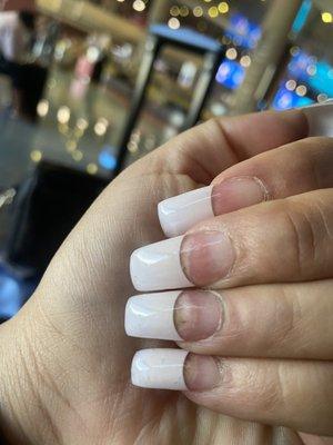 Uneven nails and lifting nails