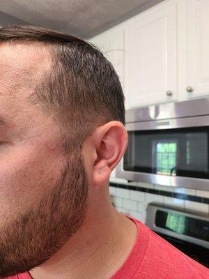 The line is clearly there.  This is a poor fade.