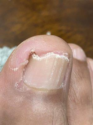 My right toe that was causing me so much pain