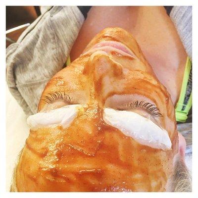 Pumpkin chemical peel + Facial while her brows numb before microblading