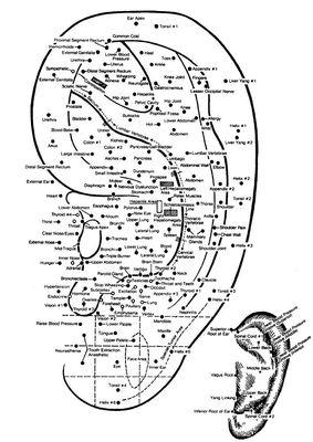 Ear Acupuncture