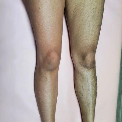 Side by side leg sugar wax