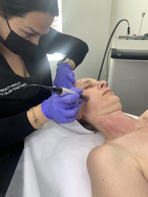 Talented Ani working her Microneedling magic