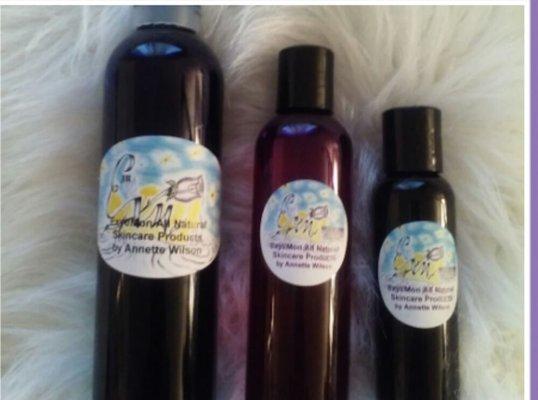 Try our Aromatherapy skin treatment made by Annette Wilson. It has no chemicals, synthetic, or over the counter drugs.