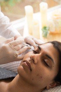 Botox to crows feet around eyes