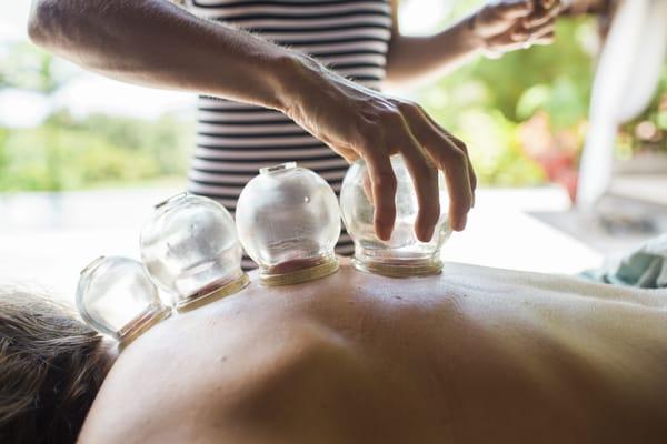 Glass fire cupping.. amazing spinal release here.