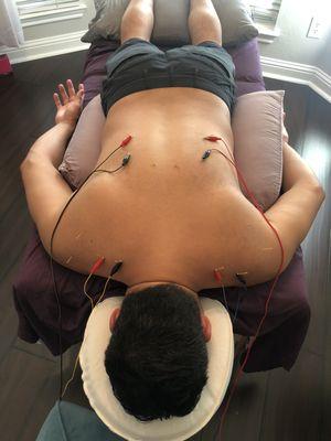 Frequently used e-Stim connection for more muscle relaxation and reset