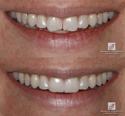 The perfect smile that makes us smile. Our board-certified prosthodontists can help your smile too!