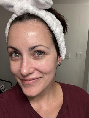 I'm 38, no make up, and this is 2 days AFTER my facial with Bella, still glowing!