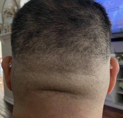 Square haircut. The worst ever.