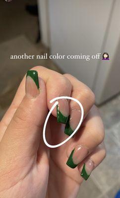 Nail color coming off.