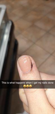 Painted the nail while it was bleeding.