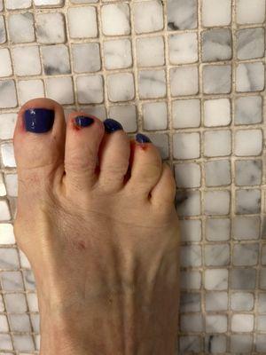 Horrible pedicure!