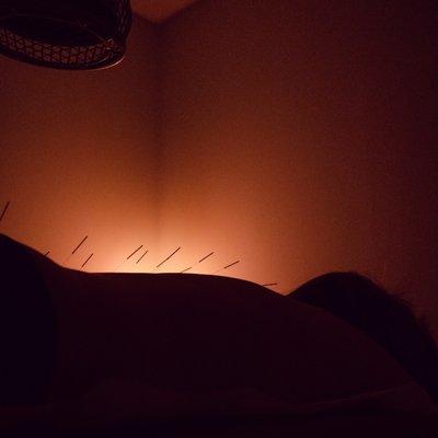 Infrared lamp, topical herbs and needles. Capturing that glowing feeling that comes with an acupuncture treatment.