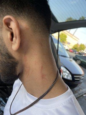 What the lady did to my neck.