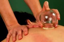 Cupping is an excellent technique for improving blood flow, easing muscle pain and clearing phlegm from the Lungs.