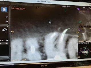 Measurement of the EXTRUSION on # 14 is 2.3mm.  That work is unacceptable.