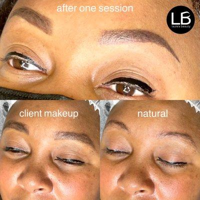 Brow makeover