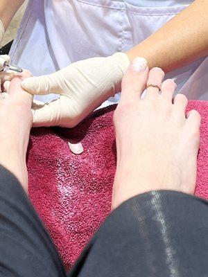 over filling the other toe