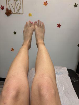 after sugaring, amazing results !!