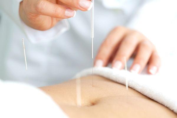 Abdominal acupuncture, great for addressing digestive disorders, menstrual issues, fertility, and many internal issues incl. weightless.