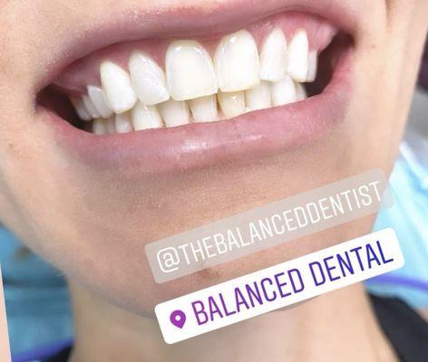 Balanced Dental