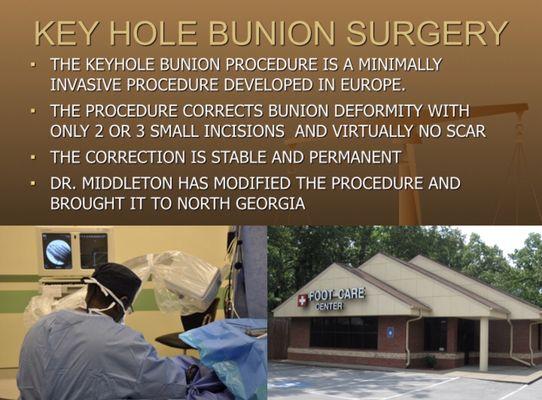 Minimally Invasive Bunion Surgery