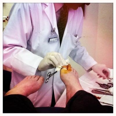 Removing a recurring ingrown toenail & using an acid to prevent more of the same.