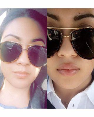 Left is from March 2017. Right is from May 2017. Went in for a touch up using Juvederm Plus. went for a more rounded top lip.