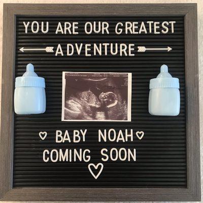 One of the adorable ultrasound pictures we received from our appointment with Tisha!