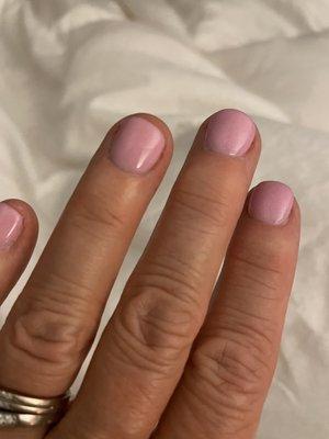 Redness on both sides of left ring finger and right side of middle finger.