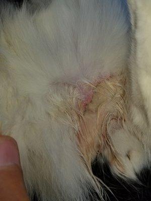 Abscess on abdomen